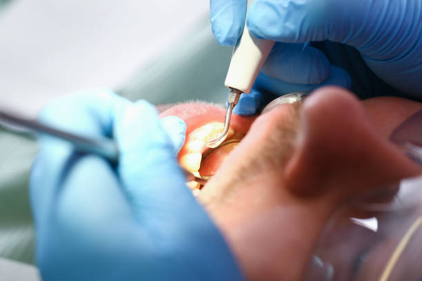 Best Urgent Dental Care for Toothache in Lake Isabella, MI